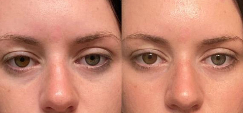 Caffeinated Sleepy Eye Serum